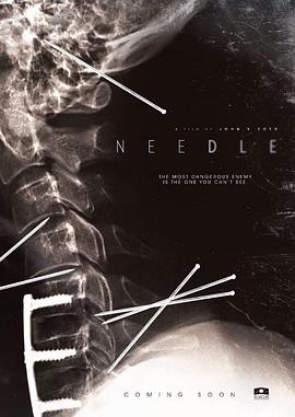 �� Needle�������