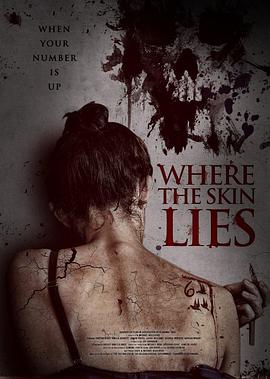 Ƥ�� Where the Skin Lies�������